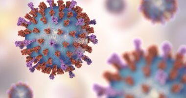 aHUS relapse triggered by COVID-19