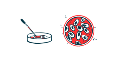 endothelial cells/aHUS News/petri dish with cells illustration