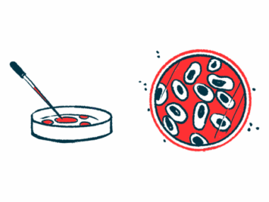 endothelial cells/aHUS News/petri dish with cells illustration