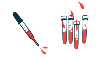 A dropper squeezes out fluid next to four vials that each contain fluid.