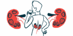 An illustration highlights the kidneys of a person seen from behind and drinking from a glass.